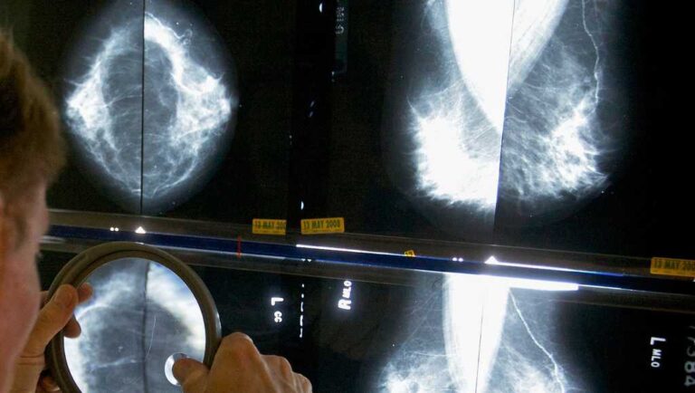 Pandemic disruptions to health care worsened cancer survival