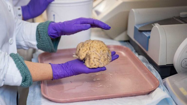 Scientists discover a key to staying mentally sharp in old age