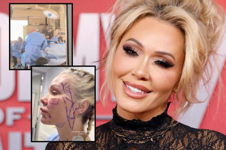 Watch Bunnie Xo’s Facelift Surgery + See Before and After Pics