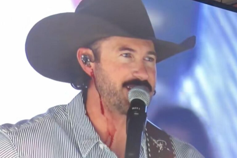 Riley Green Injured When Fan Throws Phone at His Face