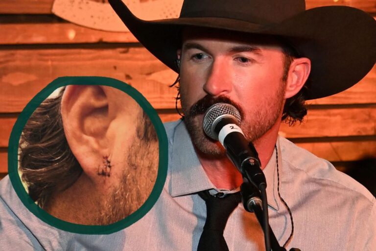 Riley Green Needed Stitches After Phone-Throwing Incident